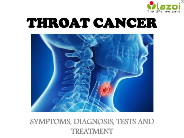Throat Cancer: Symptoms, Diagnosis, Tests and Treatment
