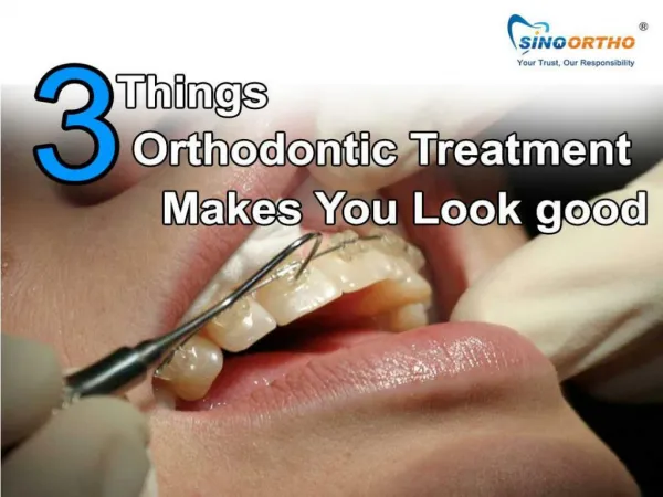 3 Things Orthodontic Treatment Makes You Look good