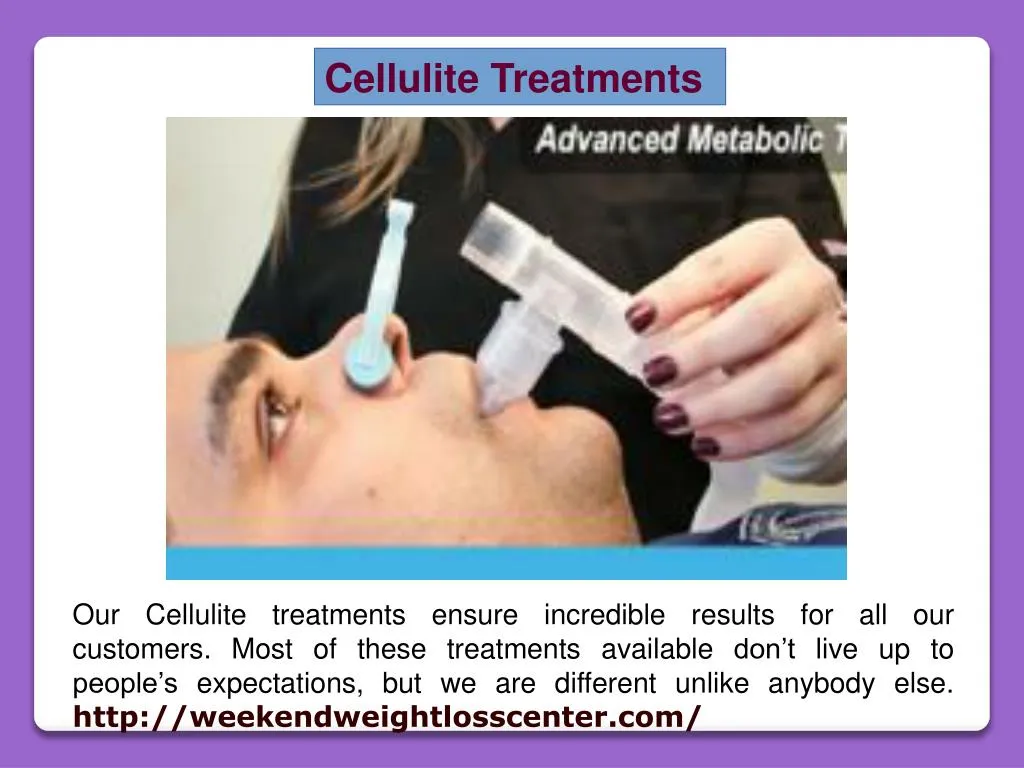 cellulite treatments