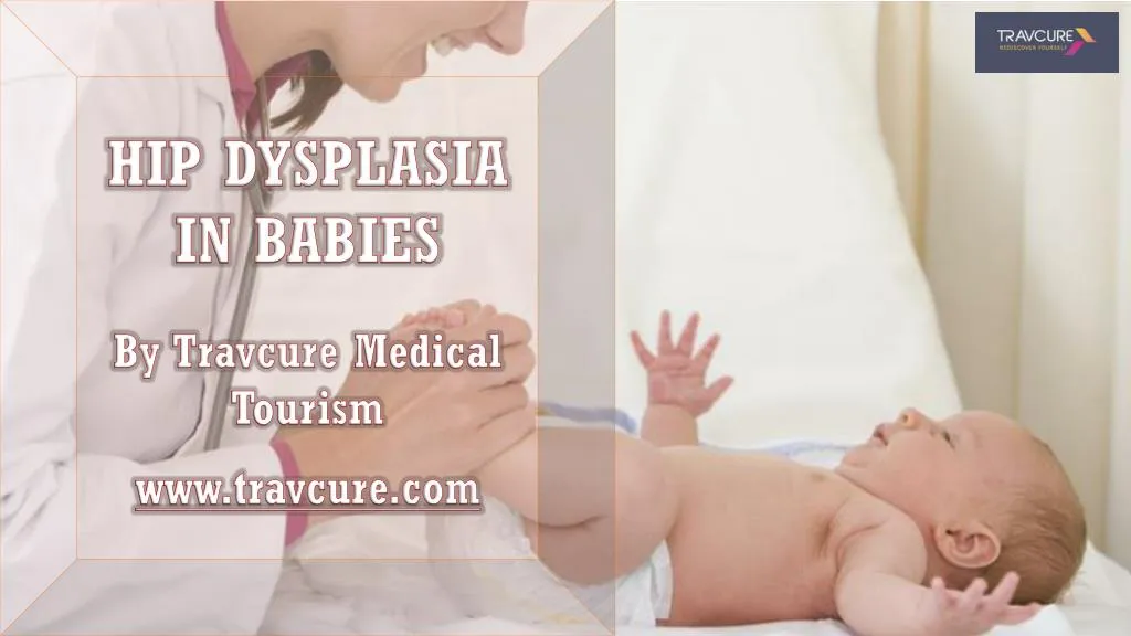 hip dysplasia in babies