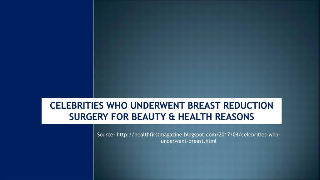 celebrities who underwent breast reduction surgery for beauty health reasons