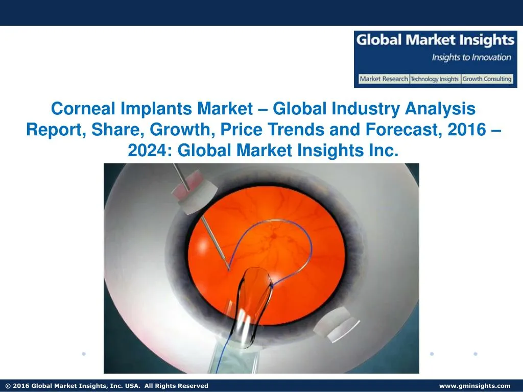 corneal implants market global industry analysis