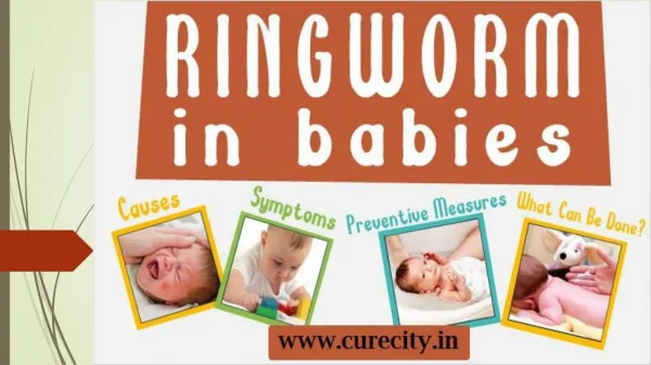 How to treat ringworm in babies - Curecity