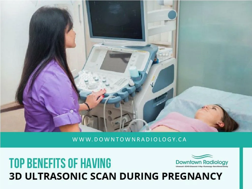top benefits of having 3d ultrasonic scan during pregnancy