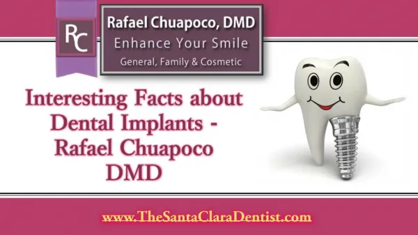 Interesting Facts about Dental Implants - Rafael Chuapoco DMD