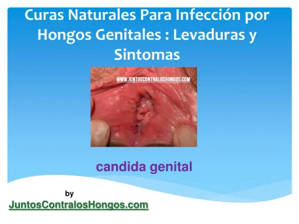 Curas naturales para infección por hongos genitales levaduras y sintomas hombres mujeres niños