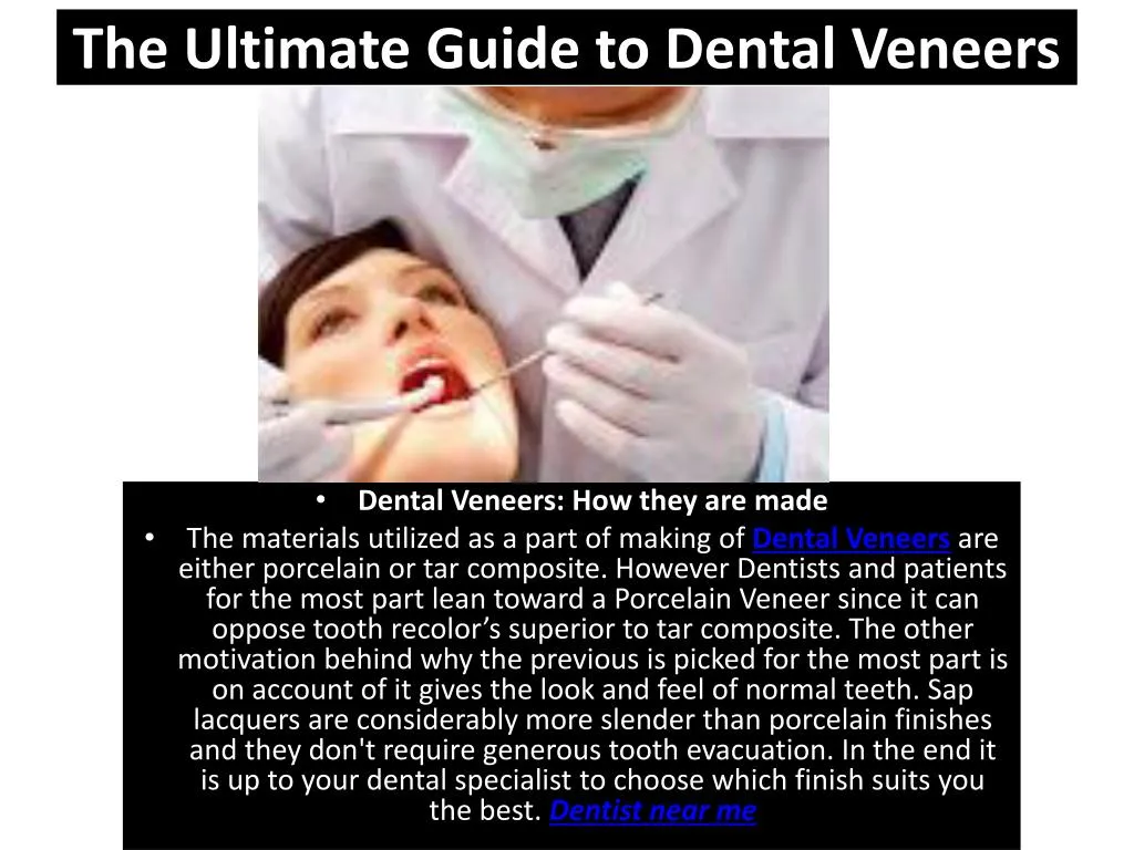 the ultimate guide to dental veneers