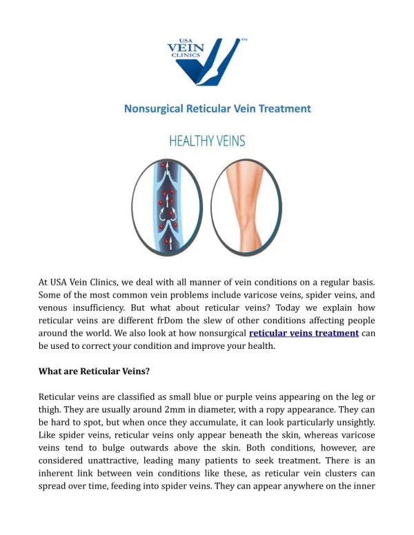 Nonsurgical Reticular Vein Treatment