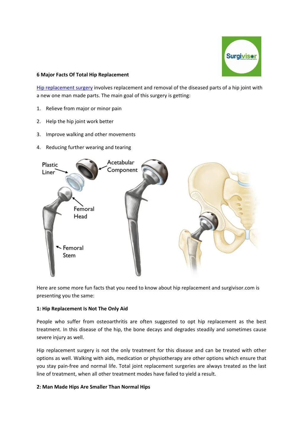 6 major facts of total hip replacement