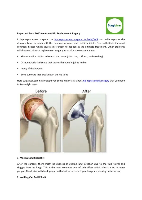 Important Facts To Know About Hip Replacement Surgery