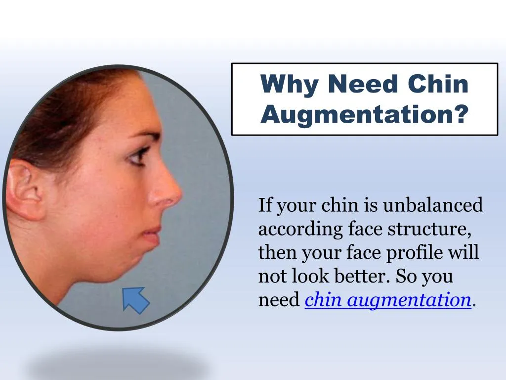 why need chin a ugmentation
