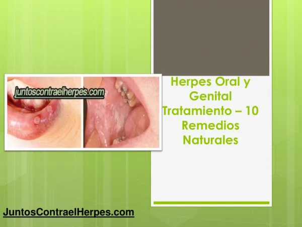 Herpes oral y genital tratamiento 10 remedios naturales