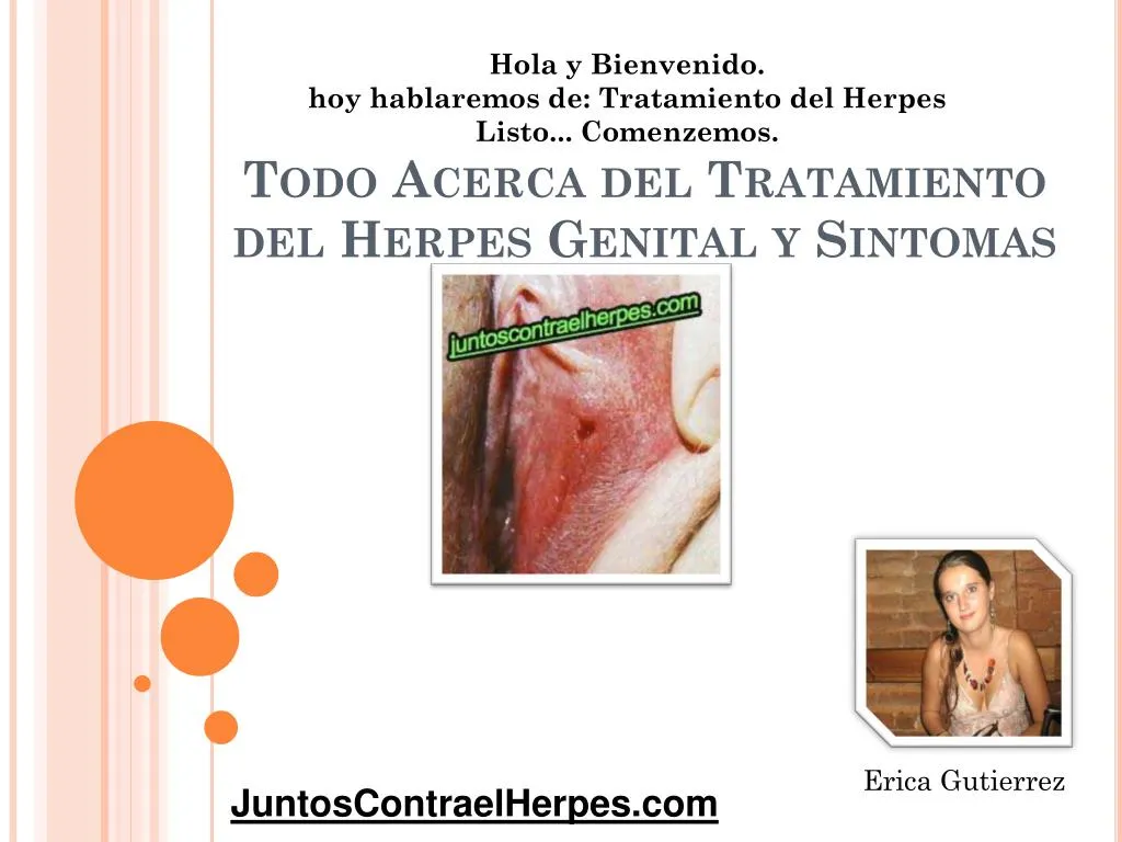 todo acerca del tratamiento del herpes genital y sintomas