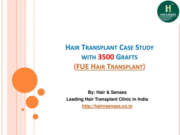 Hair Transplant Case Study With 3500 Grafts