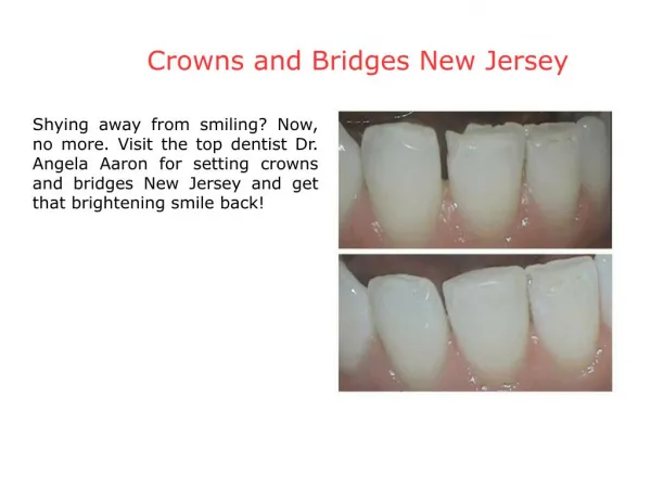 Teeth Whitening NJ
