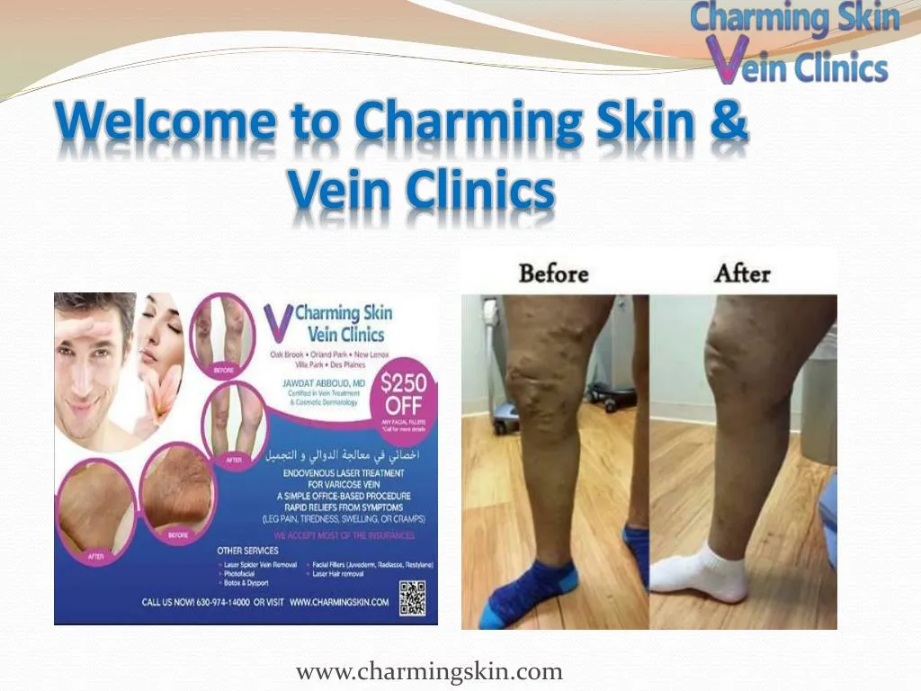 welcome to charming skin vein clinics