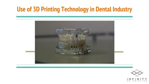 Use of 3D Printing Technology in Dental Industry