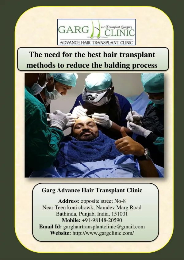 The need for the best hair transplant methods to reduce the balding process
