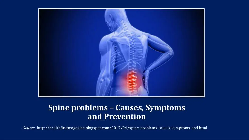 spine problems causes symptoms and prevention