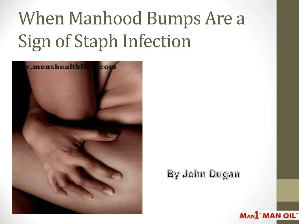 when manhood bumps are a sign of staph infection