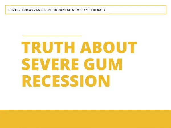 Truth about Severe Gum Recession