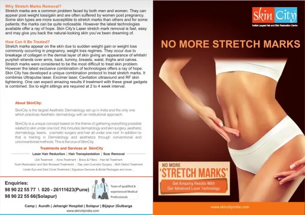 Why Stretch Marks Removal and How Can It Be Treated?