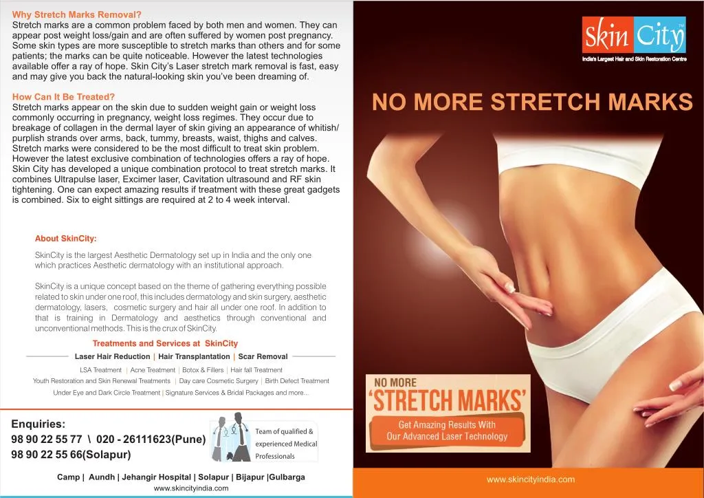 why stretch marks removal stretch marks