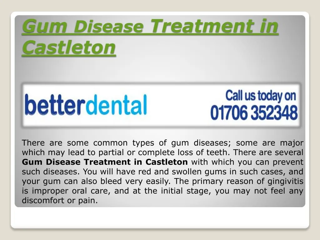 gum disease treatment in castleton