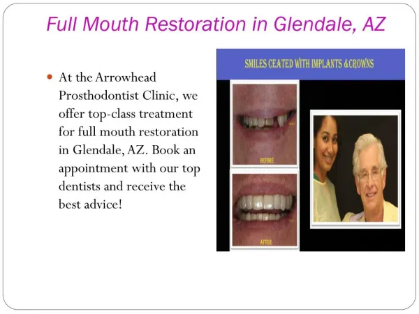 Full Mouth Restoration in Peoria, AZ