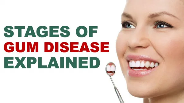 Stages of Gum Disease Explained