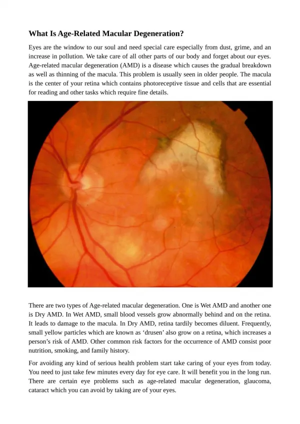 What Is Age-Related Macular Degeneration?