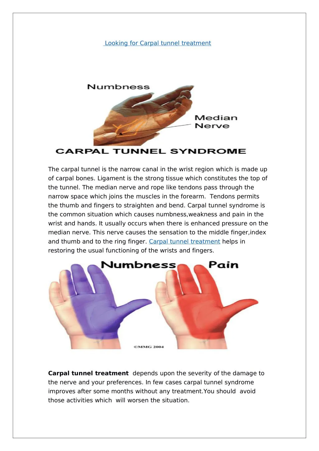 looking for carpal tunnel treatment