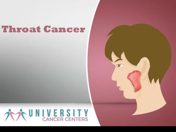 What is Throat cancer and it’s Awareness? - University Cancer Centers