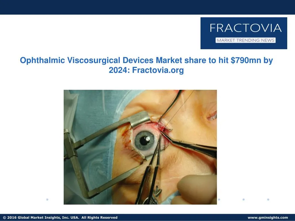 ophthalmic viscosurgical devices market share