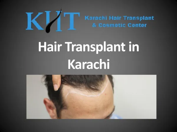 Hair Transplant in Karachi