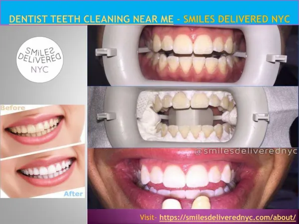 Dentist Teeth Cleaning Near Me - Smiles Delivered NYC