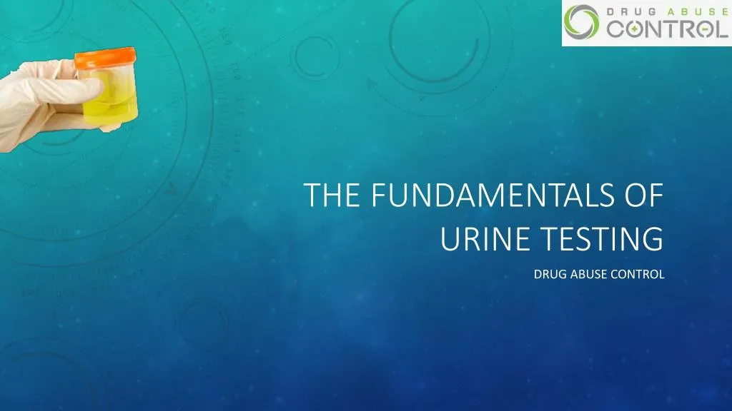 the fundamentals of urine testing