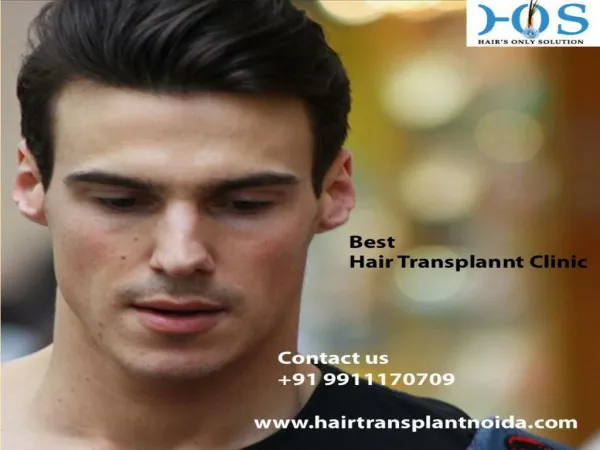 Best Hair Transplant Clinic in Noida Dial 9911170709