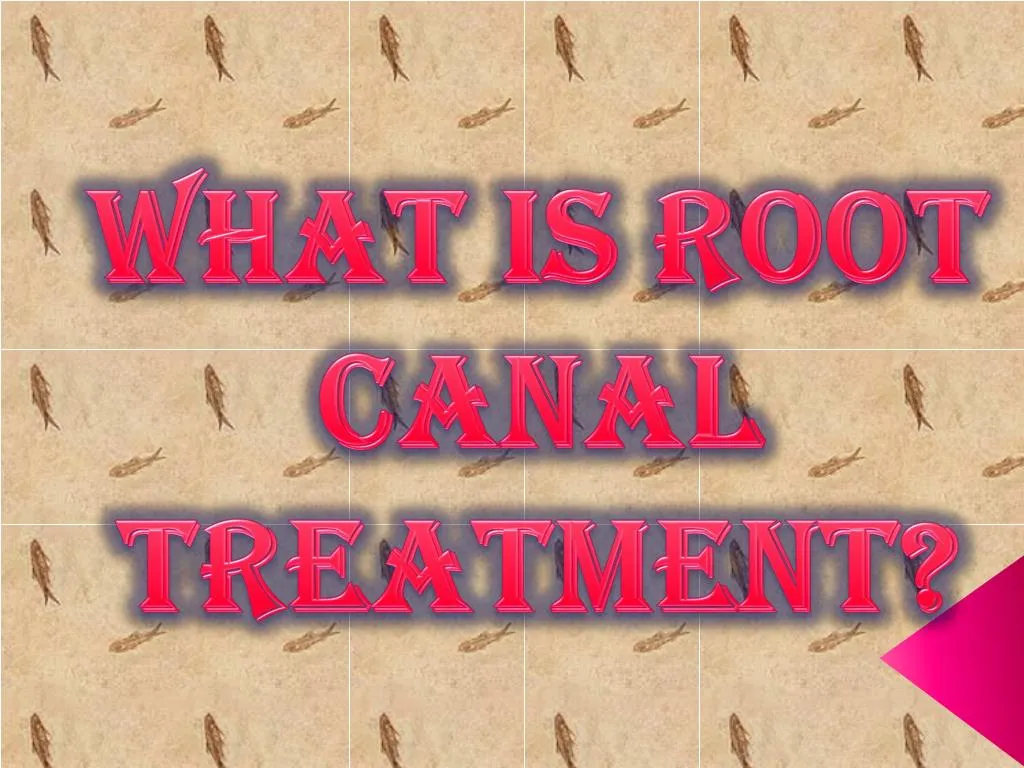 what is root canal treatment
