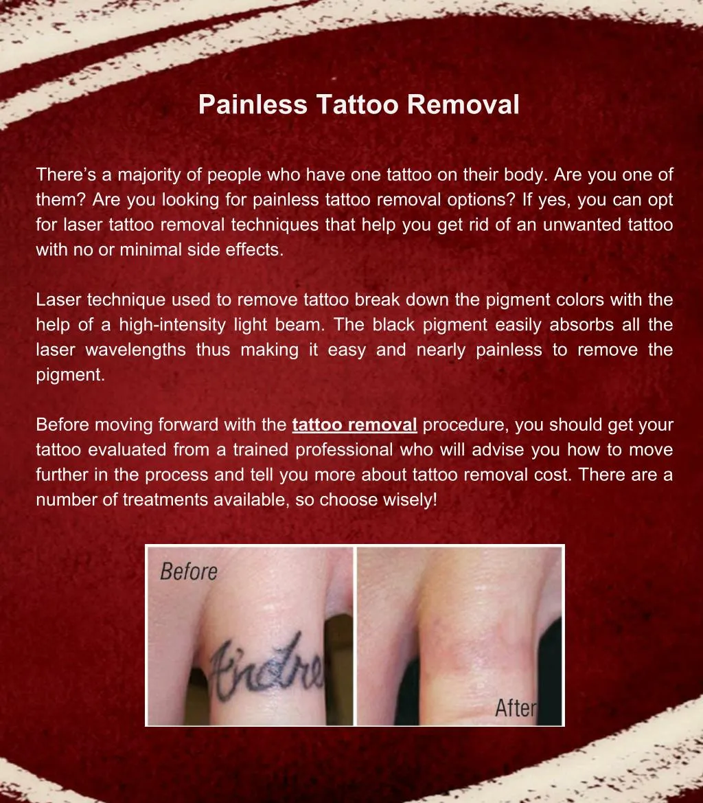 painless tattoo removal