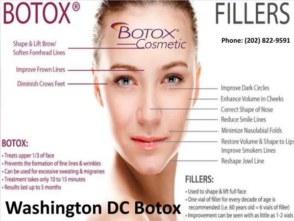 Washington DC Botox