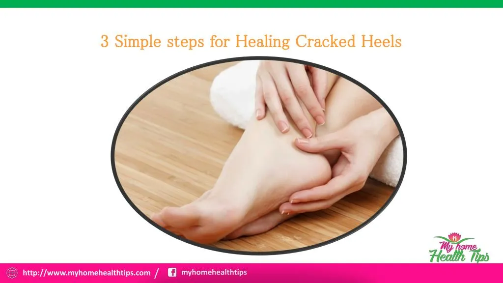 3 simple steps for healing cracked heels