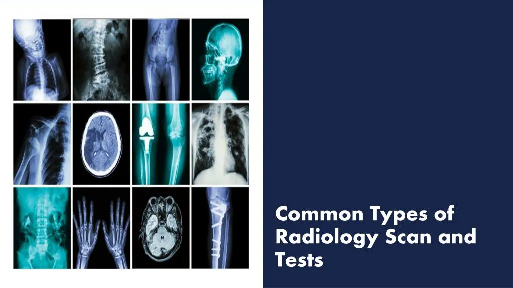 common types of radiology scan and tests