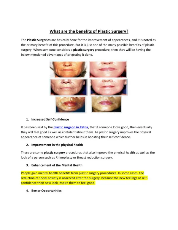 What are the benefits of Plastic Surgery?