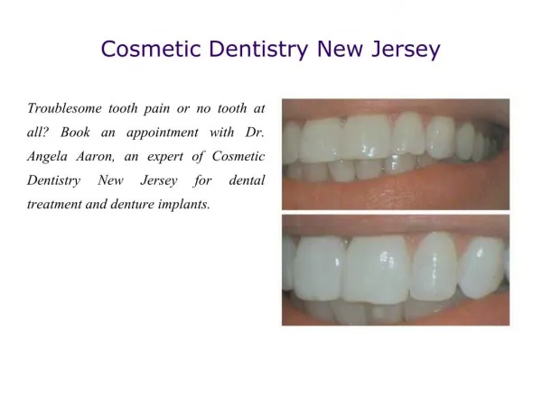 Cosmetic Dentistry New Jersey