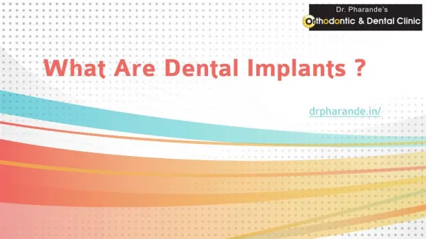 What Are Dental Implants ?