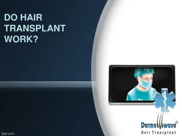 Do Hair Transplant Work?