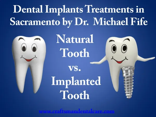 Dental Implants Sacramento California by our Implant Dentist Dr. Fife
