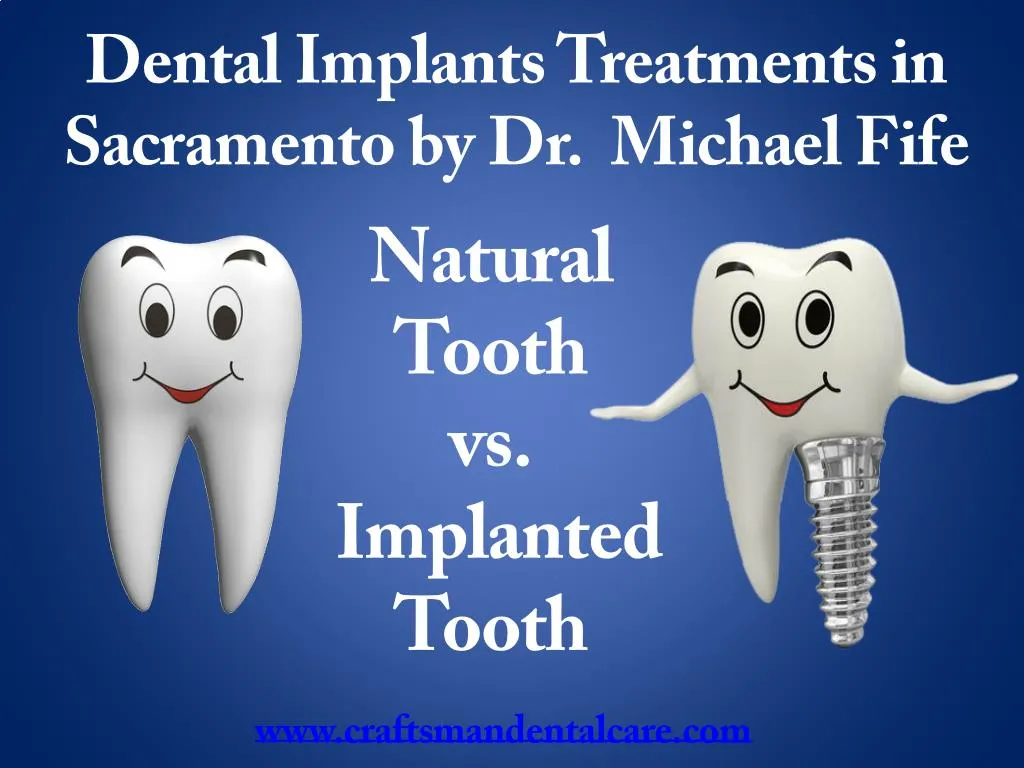 dental implants treatments in sacramento