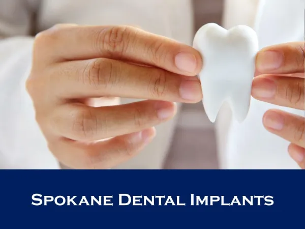 Spokane Dental Implants